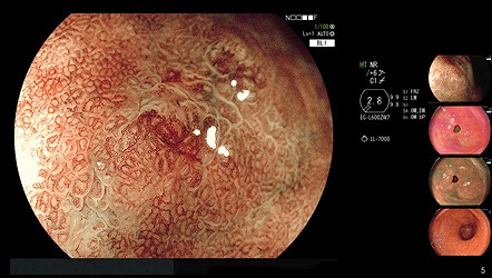 大型ハイビジョン液晶モニターでリアルタイム画像を確認